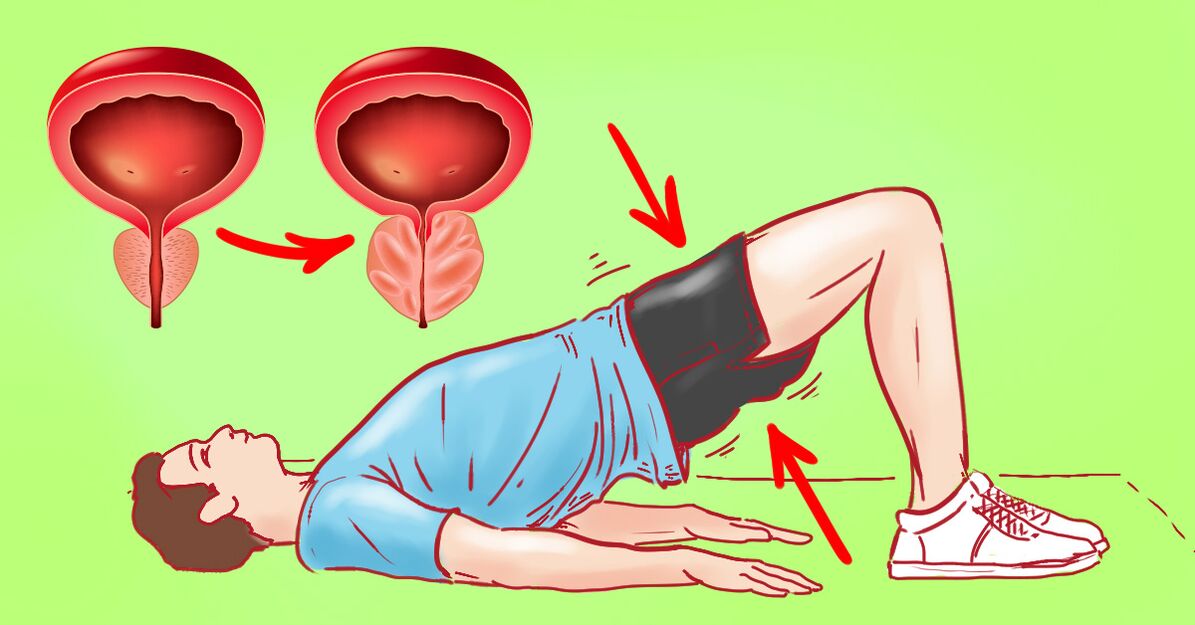 exercícios de ginástica para prostatite